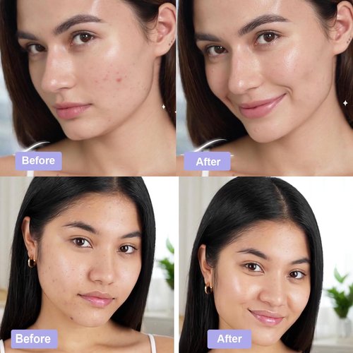 Madecassoside Toner Pads, Mild Exfoliating Pads, Calming Blemish Face Pad -Centella, Niacinamide, BHA Salicylic Acid for Soothe, Uneven Skin Tone, Dark Spots, Skincare 125 Pad Valentines Day