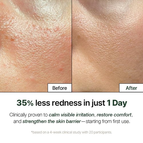 Natural Derma Project NDP Cica Cream - Lightweight Gel Moisturizer for Sunburn Relief | Hydrating & Soothing (1.7 Fl oz / 50ml)