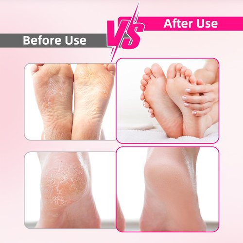 Cordless Electric Foot File & Callus Remover - Professional Pedicure Tool with 4 Nano Glass Grinding Heads, Dead Skin Remover for Cracked Heels and Rough Feet - Rechargeable Foot Sander