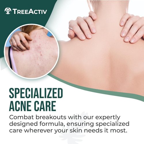 Back Acne Spray by [Brand Name] - Fast-Drying Tea Tree Oil & Aloe Mist with 2% Salicylic Acid | 4 fl oz