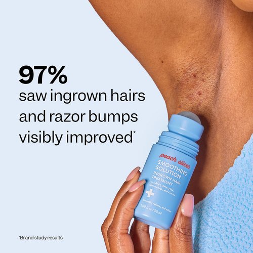 Peach Slices Ingrown Hair Treatment - Smoothing Solution with BHA, AHA, Niacinamide | 1.69 oz Vegan & Cruelty-Free