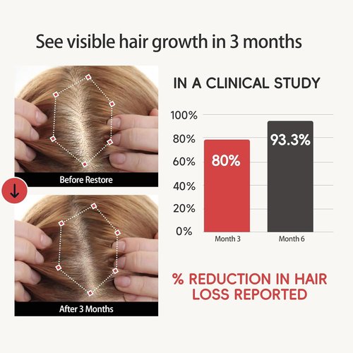 Biotin Ginger Volumizing Shampoo - Lightweight Cleansing for Oily Scalp & Fine Hair | Daily Refreshing Care