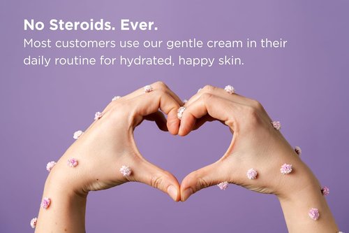 Seborrheic Dermatitis Face Cream by [Brand Name] - Hydrating & Barrier-Supporting Formula with MCT Oil & Squalane - Gentle Moisturizer for Face, Scalp & Body