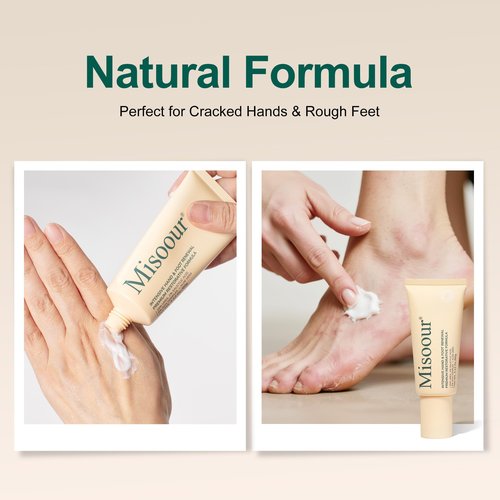 Misoour 25% Urea Hand Cream for Feet with 2% Salicylic Acid & 5% AHA+Aloe Vera, Urea Foot Cream for Dry Cracked Hands, Heels and Feet, Moisturizer and Repair for Rough Skin