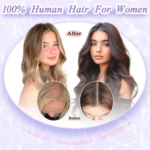 LEDIZE Hair Toppers for Women Real Human Hair, 360° Cover Middle Part Human Hair Toppers for Women with Thinning Realistic Scalp Line Upgrade Basement Toppers Hair Pieces Medium Brown, Side Bangs
