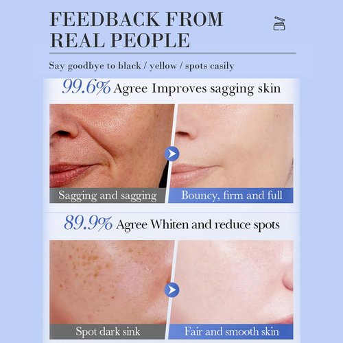 Regine Switzerland Salicylic Acid Face Cream - Oil-Free Acne & Pore Refining Moisturizer for Oily Skin