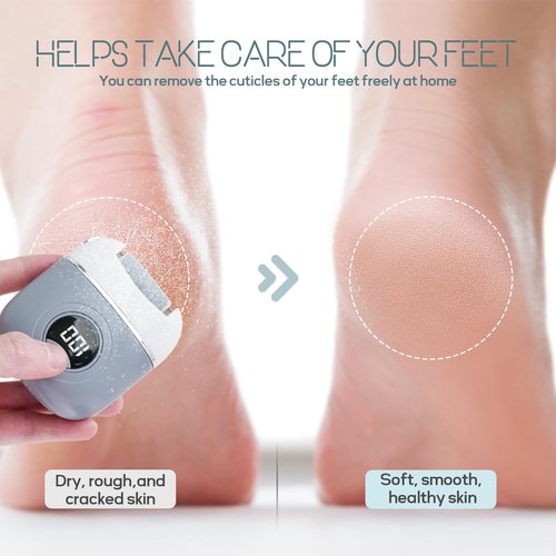 KAZLIE Electric Foot Callus Remover, Rechargeable & Waterproof Pedicure Tool with 3 Roller Heads, 2 Speeds for Dead, Hard, Cracked, Dry Skin Care
