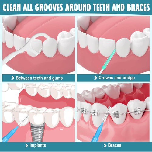 Lezmarket 450PCS Interdental Brushes and Flosser Picks Kit, Braces Brushes, Soft Picks and Dental Floss Sticks for Teeth, Braces Cleaner Brush Tooth Floss Pick Between Teeth Brushes for Braces