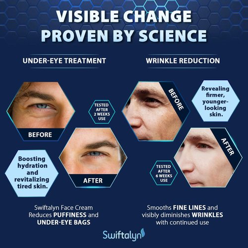 Swiftalyn 6-in-1 Face Cream for Men: Men's Face Moisturizer Anti-Aging Cream, Dark Spot & Eye Bag Treatment, Reduces Wrinkles – Men's Skincare