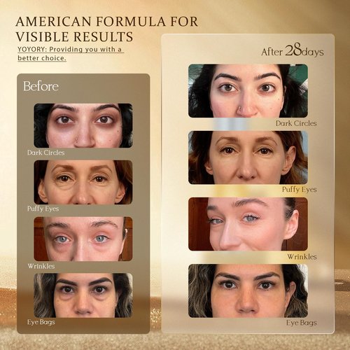 Retinol Under Eye Cream - Anti-Aging Eye Cream for Dark Circles and Puffiness, Eye Bags, Wrinkles Fine Lines Skin Care Treatment Hydrates & Lifts Valentine's day gifts (20ml)