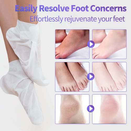 5 Pack Moisturizing Foot Mask,Hydrating Foot Masks for Dry Cracked Feet,Moisturizing Socks Dry Skin Moisturizer for Soft and Smooth Touch Feet,Foot Care Spa Gifts for Women Men Easter Basket Stuffers