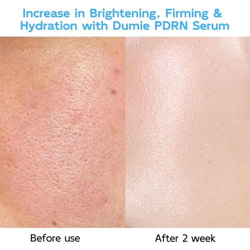 **Skiennix Salmon DNA Anti-Aging Serum - 5000ppm Salmon Egg DNA & 2000ppm Collagen, 30e**