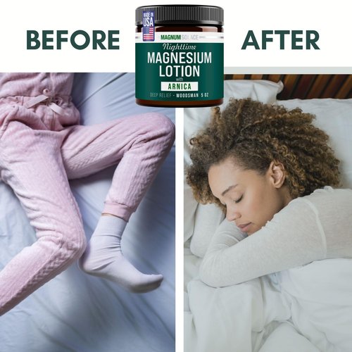 Nighttime Magnesium Lotion with Arnica – Soothing Relief & Relaxation, Highly Concentrated Magnesium for Muscles & Joints – Apply to Legs or Feet Before Bed – Skin-Friendly