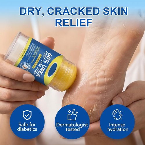 Regine Switzerland 60% Urea Cream Stick - Maximum Strength Foot Cream with 2% Salicylic Acid for Dry, Cracked Heels | Rapid Callus Remover