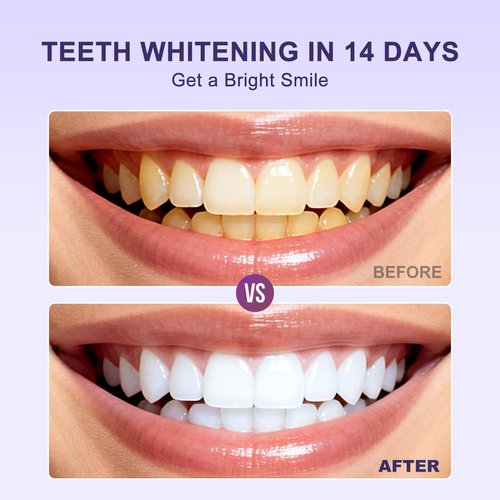Purple Teeth Whitening Strips -28 Pieces,Say Goodbye to Stains and Bad Breath from Smoking, Alcohol, and Coffee. Suitable for Sensitive Teeth, Create a Beautiful and Confident Smile (14 Pairs, Mint)