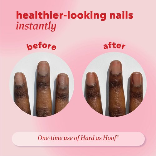 Onyx Professional Nail Strengthening Cream - Unscented Formula for Growth & Conditioning, 1 oz