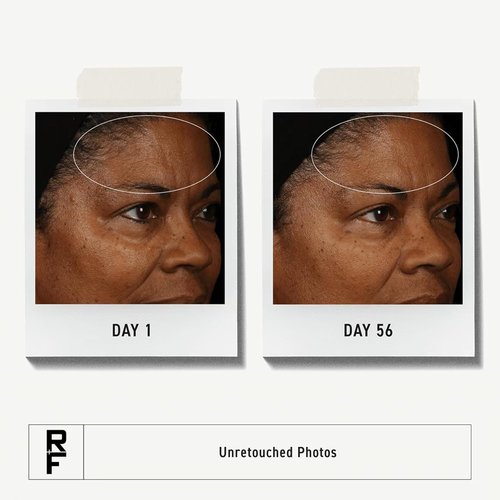 Rodan + Fields Redefine Regimen - Complete Skincare Kit with Clay Cleanser, Toner & Creams | Perfect Gift Set for Women