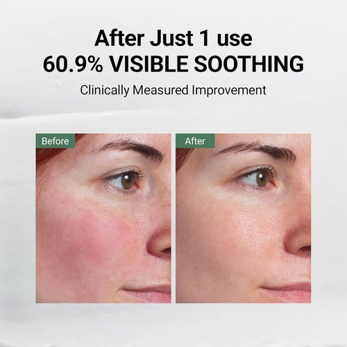 DA EFFECT Post Care Balm - Advanced Barrier Repair Moisturizer & Hydrating Face Cream, 30ml