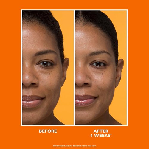 Peter Thomas Roth | Potent-C™ Brightening Vitamin C Moisturizer - Revitalize Skin Tone & Texture