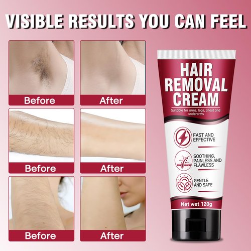 Hair Removal Cream for Women, Crema Depiladora Para Mujer, Fast-Acting, Effective Painless Flawless Depilatory Cream for Legs, Arms, Underarms, Stomach, Pubic Area and Bikini Line 120g