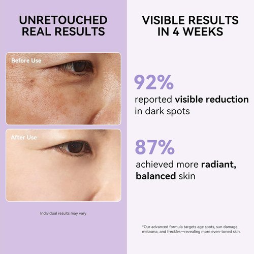 Regine Switzerland Dark Spot Remover Serum - Corrects Sun, Age, & Brown Spots | Evens Skin Tone, 1.7 Fl Oz