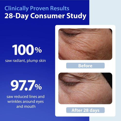 Dr. Denese SkinScience HydroShield Ultra Moisturizing Face Serum 1 oz – Retinol & Ceramide Formula for Deep Moisture, Radiant Smooth Skin, Fine Line Care – Dermatologist Tested & Cruelty Free