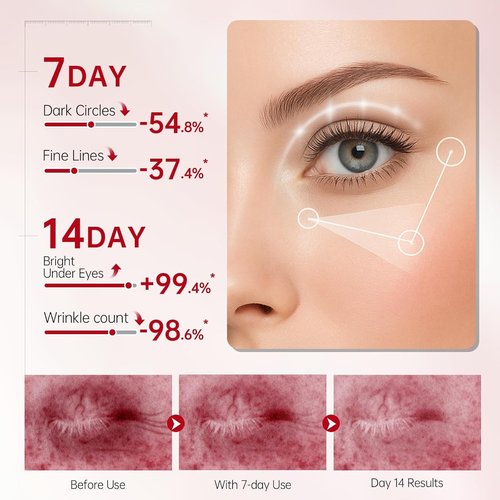 Peunitory Eye Balm Stick - Anti-Wrinkle Under Eye Cream | Dark Circle Brightener | Hydrating (0.32oz)
