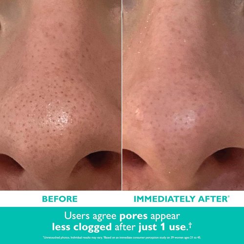 Peter Thomas Roth | Even Smoother™ Microdermabrasion Exfoliator - Salicylic Acid for Oil Control