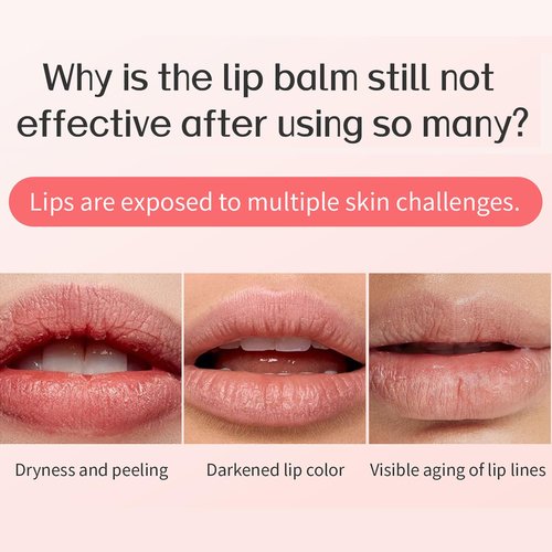 Skiennix Lip Sleeping Mask - Overnight Hydration for Dry, Chapped Lips | Vegan & Cruelty-Free, 20g