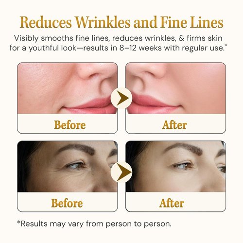 **Regine Switzerland Anti-Aging Serum - Matrixyl 3000 with Hyaluronic Acid & Peptide Collagen | 1.01 Fl Oz**