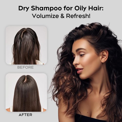 Dry Shampoo Spray by [Brand Name] | Residue-Free, Volumizing Formula with Rice Starch - 5.07 oz
