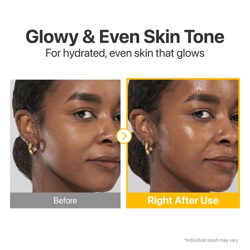 Numbuzin No.5 Vitamin Serum - Dark Spot Care with Glutathione & Tranexamic Acid | 1.01 fl oz for Radiant Skin