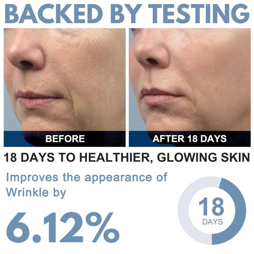 Ribose Cream - Anti-Aging Moisturizer with D-Ribose & Coconut Oil | Reduces Wrinkles, 2.5 oz
