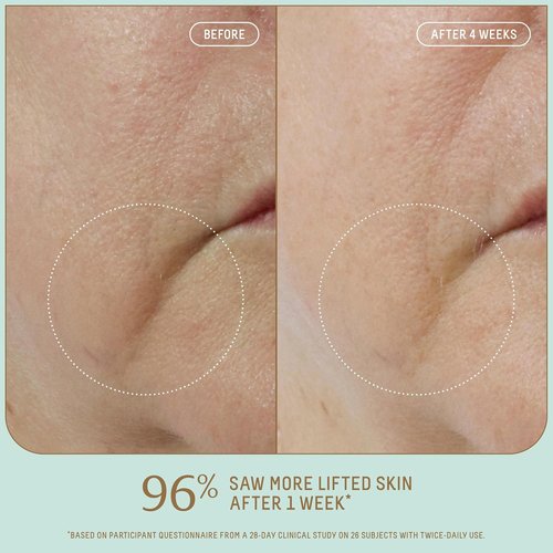 Biossance Squalane + Firm & Lift Dual Serum - Anti-Aging Face Serum for Maturing Skin - 30ml