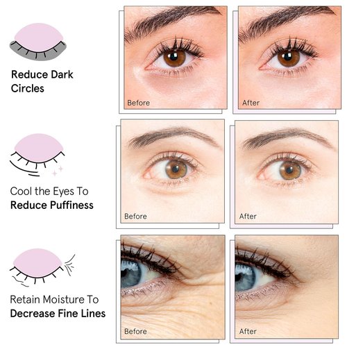 Grace & Stella Under Eye Mask Variety Pack - 18 Pairs of Gel Patches for Dark Circles - 6 Colors | Vegan Mother's Day Gift