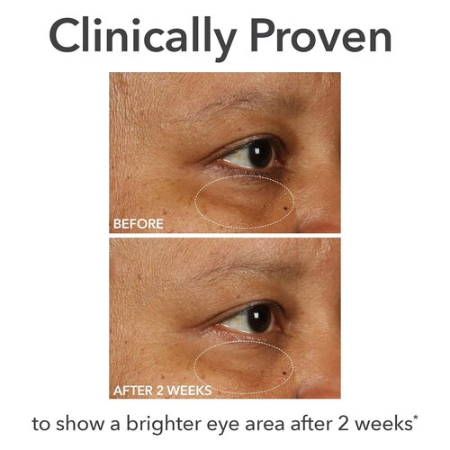 Dr. Dennis Gross DermInfusions Eye Cream - Hydrating & Brightening Treatment for Dark Circles, 0.5 Oz