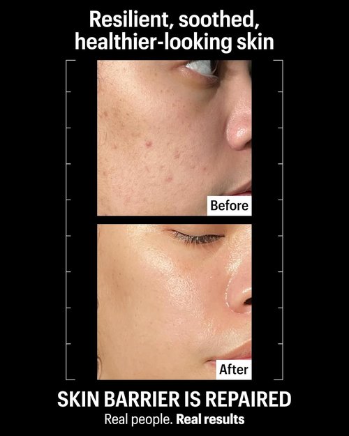 Allies of Skin Molecular Barrier Repair Cream Balm - Deeply Hydrating Face Moisturizer with Ceramides & Squalane | 1 fl oz for Irritated Skin