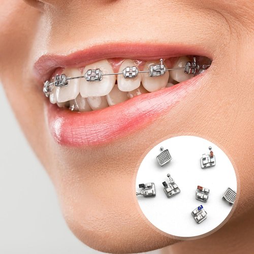 SEAVERRS 100pcs/Pack 022 Slot Bondable with Hook on 345 Teeth Model Mini Roth Brackets Roth,5 pieces per pack 20 pieces per pack. (5 pcs)
