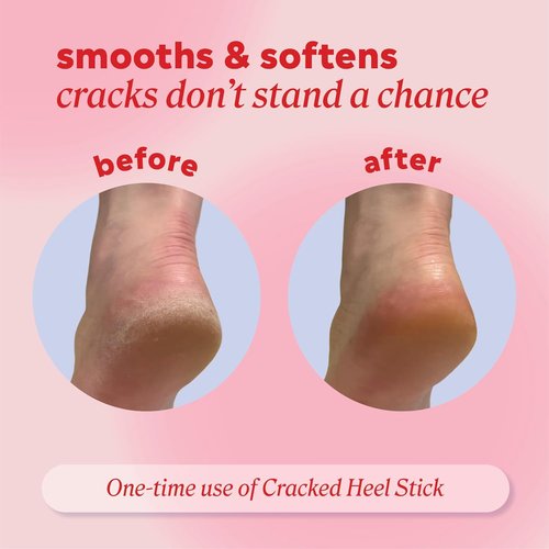 Onyx Professional Cracked Heel Repair Balm Stick - Moisturizing Treatment for Dry Feet, Coconut Scent, 1 Pack