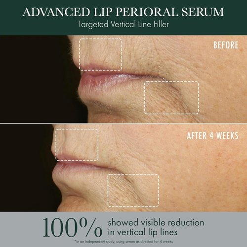 RéVive Advanced Perioral Lip Serum - Anti-Aging Treatment for Lip Lines & Wrinkles | Restores Contour & Fullness (0.5 fl oz)