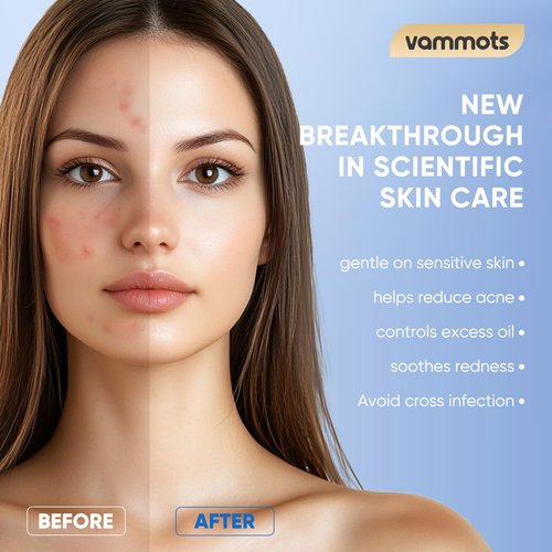 vammots Disposable Face Towels,Biodegradable Ultra Soft Washcloths for Sensitive Skin,Suitable for Facial Cleansing,Skin care and Makeup Removal,Lint-free,Trave,Daily Cleansing,100 Count