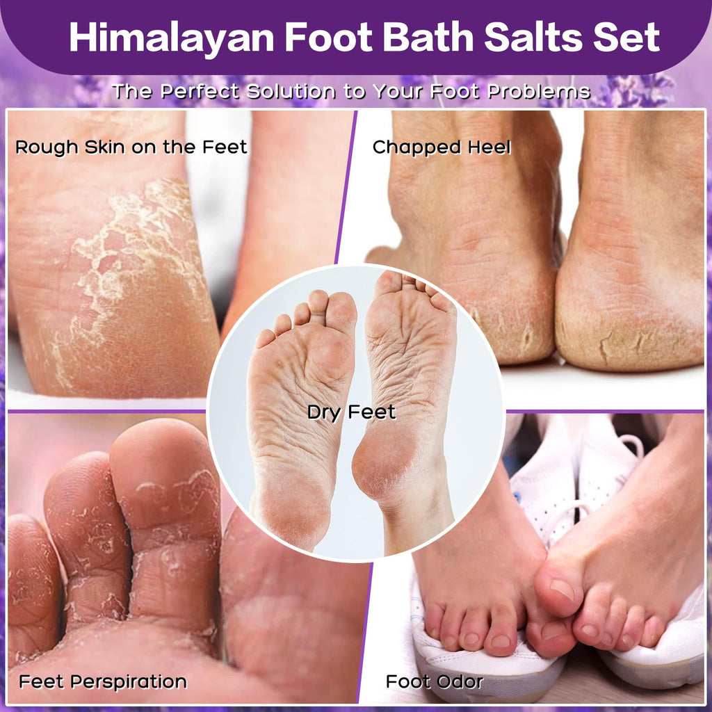 XIWEIOO Tea Tree Oil Foot Soak Stubborn Foot Odor, Athletes Lavender Foot Soak with Pure Epsom Salt Soak Pedicure Salt Athletes Foot & Stubborn Foot Bath Salt Softens Calluses & Soothes Foot Care spa…