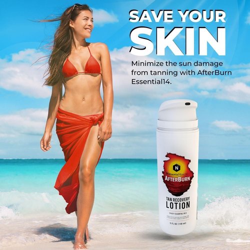 Nirvanta All-in-One AfterBurn Tan Recovery Lotion – Doctor-Formulated Aftersun Lotion w/Natural Ingredients & 14 Essential Oils for All Ages – After Sun Care for Deep Hydration & Peeling Minimization