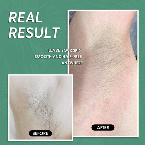 Maxpearl Wax Beads for Hair Removal, 2.5lb Hard Wax Beans Refill Bag for Brazilian Bikini, Face, Eyebrows, Underarms, Arms, Chest, Back, Legs, Coarse Body Hair Specific