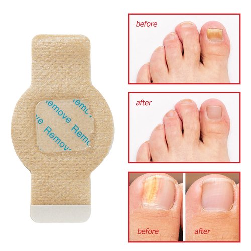 Nail Patches for Toenails & Fingernails – 63Pcs Parches para uñas con hongos, 8-Hour Fungus Nail Care Repair Stickers for Damaged Nails, for Extra Strengthening, Safe for Sensitive Skin
