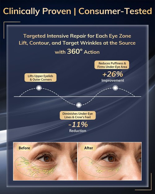 Under Eye Red Light Therapy Device, Red Light 630±10nm Therapy Glasses for Eyes, Red Light Eye Mask for The Treatment of Eye Bags,Dark Circles,Puffiness periorbital for Treating -Blown