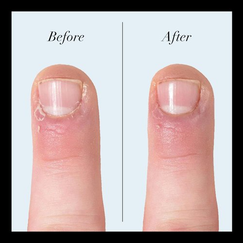 butter London Quick Slip Cuticle Oil for Nails - Revitalizing Cuticle Oil Treatment Softens, Hydrates & Strengthens with Biotin, Horsetail Extract, Vitamin B & Calcium - Fast-Drying Nail Care