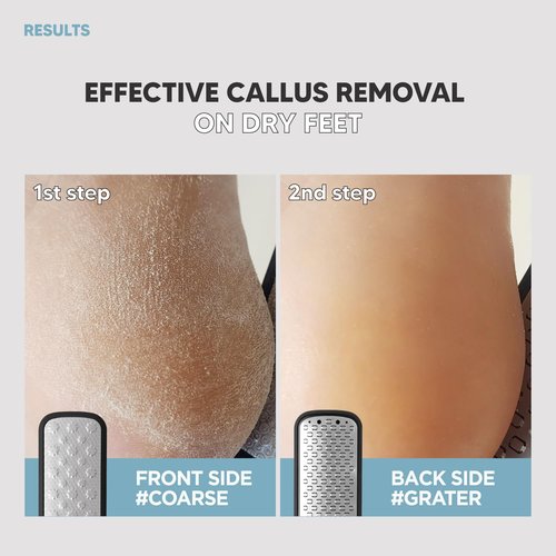 F3 Systems, 2Steps Stainless Steel Callus Remover, Effective for Thick Callus and Cracked Feet Pedicure Rasp, Remove Hard Skin, Grater Foot File, Foot Scrubber, Professional Foot Care