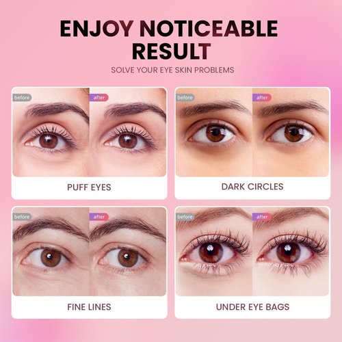 AILEORY Under Eye Patches (24 Pairs) - Tri-color Glitter Eye Gel Pads for Dark Circles, Puffy Eyes, Under eye Bags, Wrinkles | Natural Collagen Under Eye Mask Patches, Valentines Day Gift for Her