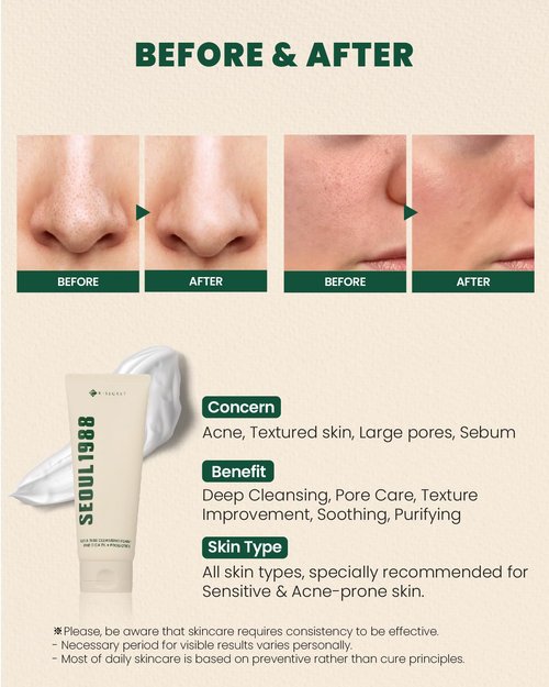 K-SECRET SEOUL 1988 Cica Cleansing Foam – Deep Pore Cleansing & Soothing Care | Daily Facial Cleanser for Sensitive Skin | Korean Skincare, 150ml / 5.07 fl oz
